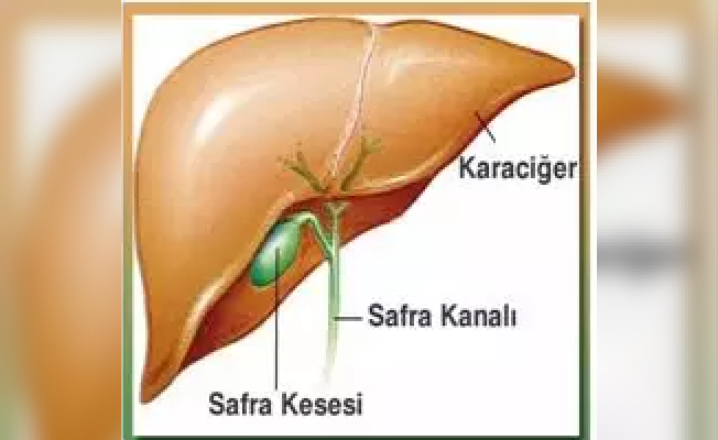 Safra Kesesi Ameliyatı